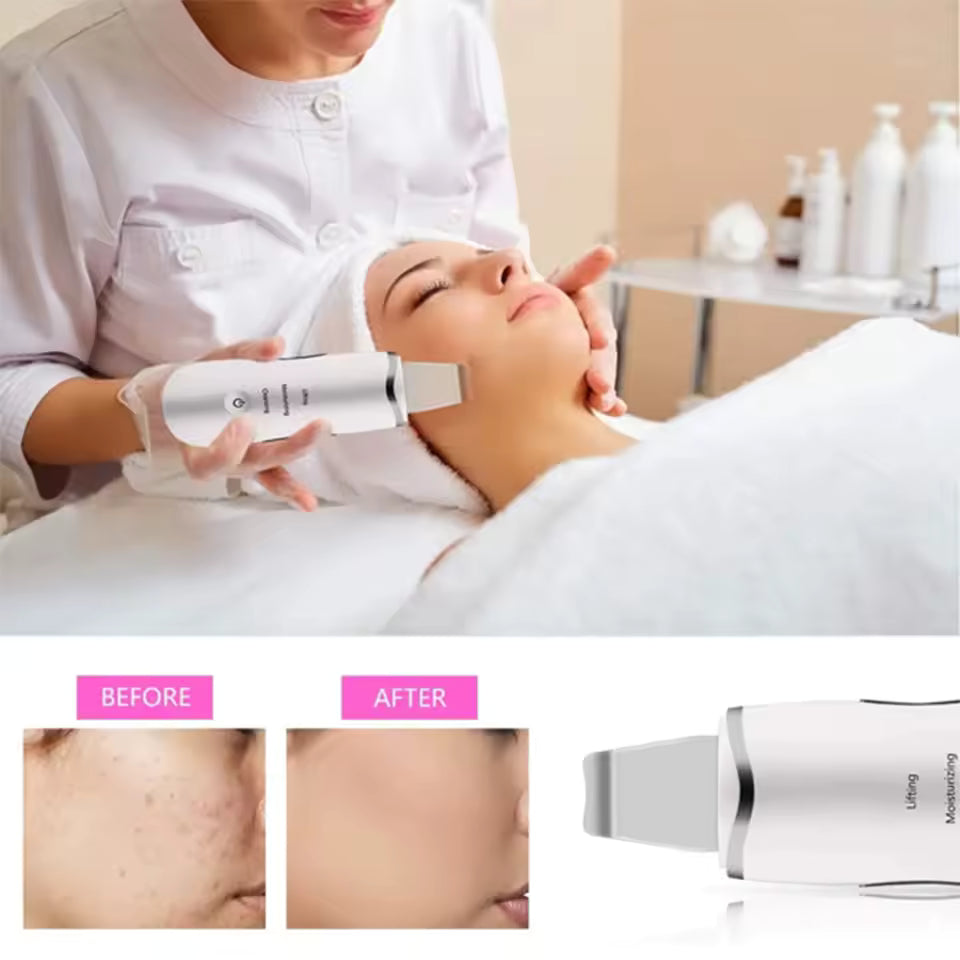 3-in-1 Ultrasonic Skin Scrubber Facial Cleaner